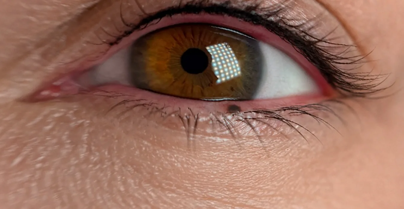 Wimpernkranz · Ergebnis nach der Heilung